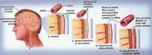 vasodilation